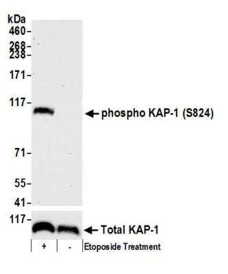 Western Blot: KAP1 [p Ser824] Antibody [NB100-2350]